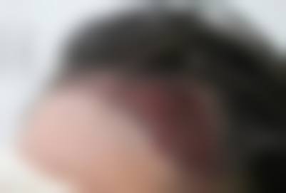 八、驻马店阮夏君医学美容诊所真实的顾客评价如下: