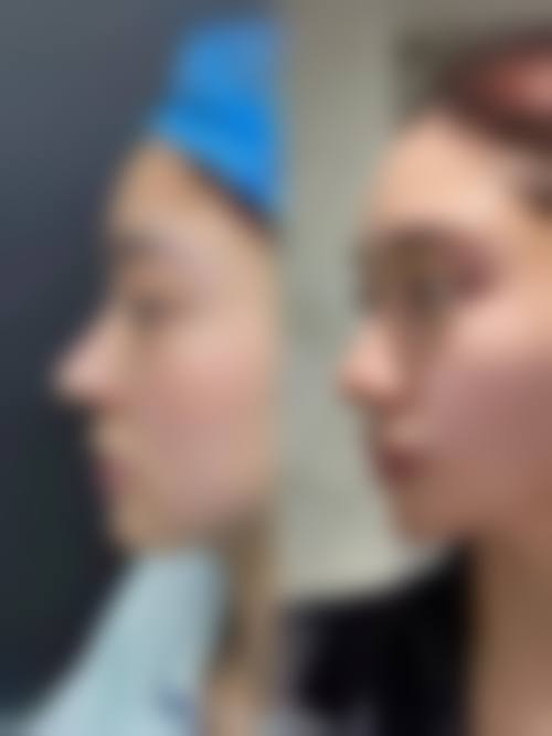 四、长春一妍针美整形医院开展的主要项目和特色项目：