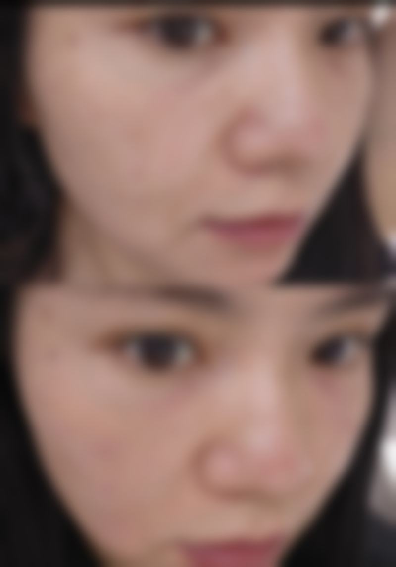 脸上疤痕怎么去除？重焕细嫩光彩不是梦