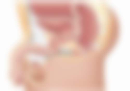 上海德琳医疗美容医院(韩国Dream分院)乐威男性增粗、阴茎延长手术操作步骤