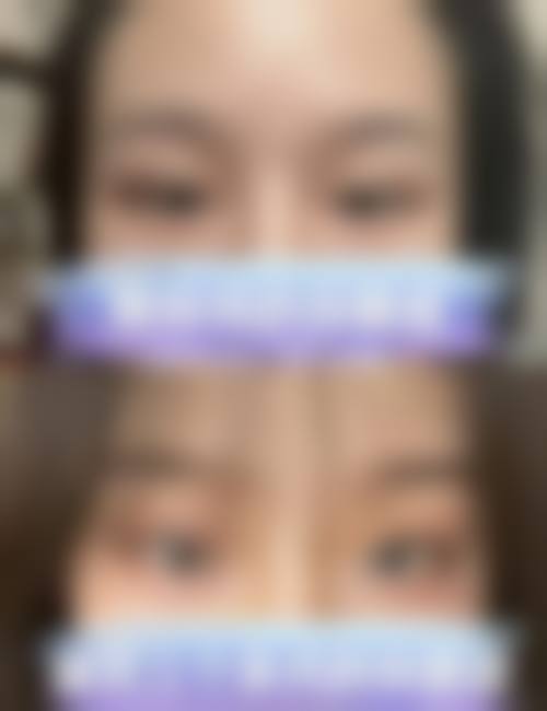 五、聊城整形美容医院实例