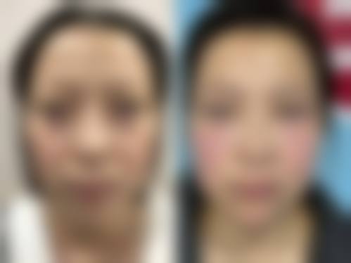 五、太原宏远爱谛整形医疗美容门诊部怎么预约: