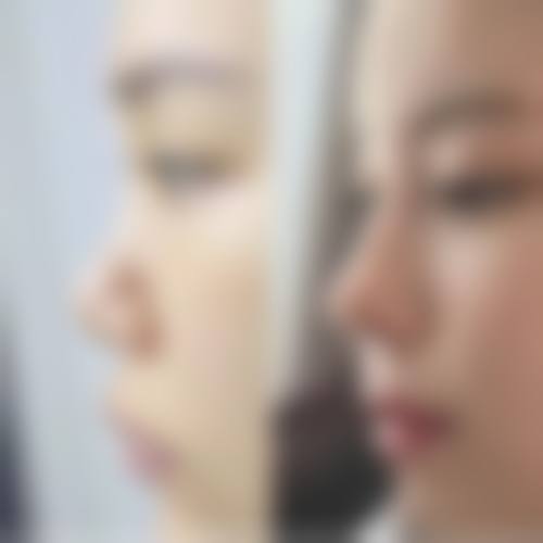 四、韩国Hansarang女性整形医院开展的主要项目和特色项目: