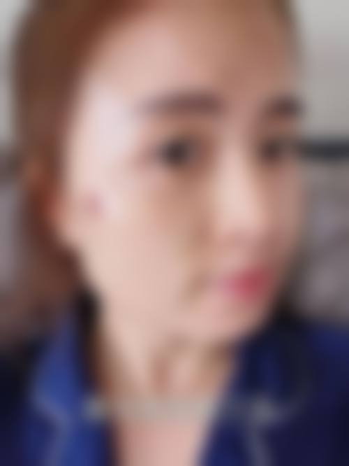 五、南宁艾媚儿医疗美容门诊部怎么预约: