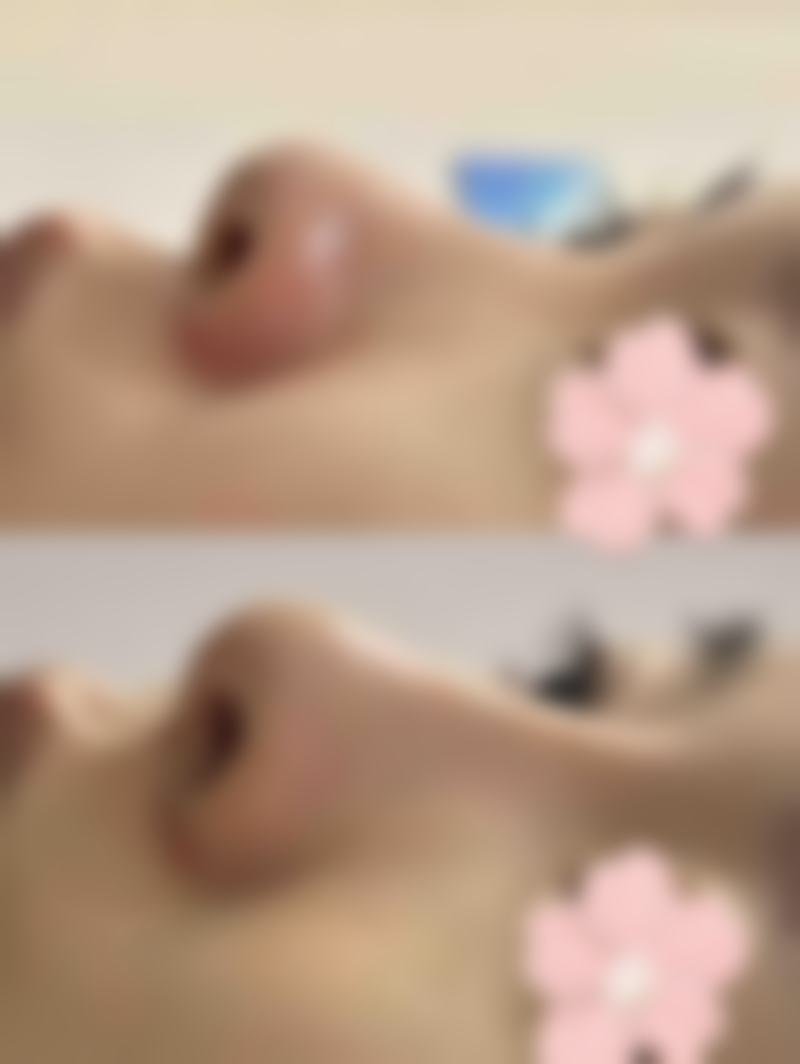 七、韩国Hansarang女性整形医院价格表:(仅供参考)