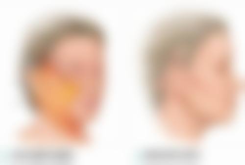 用户使用美皮护淡化疤痕红印的实际体验如何？