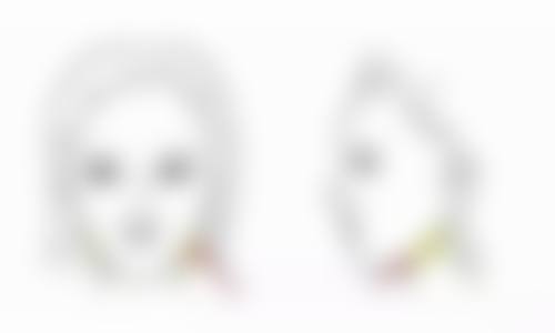 埋线与切开双眼皮怎么选？对比修复周期