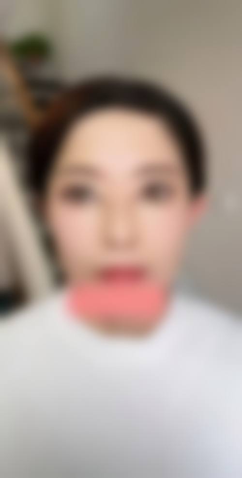 八、柳州华 山医院臻潼彦医疗美容诊所真实的顾客评价如下：