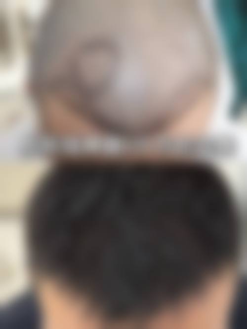 二、西安交大二附院植发科正规吗?来看看医院资质: