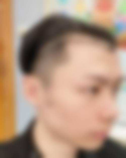 四、西安交大二附院植发科基本信息: