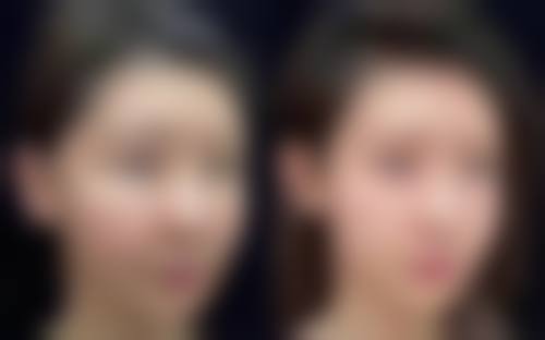 八、德州韩绣医疗美容诊所真实的顾客评价如下:
