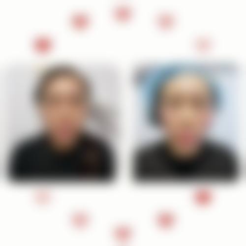 四、泉州斯美乐轮毂整形美容医院实例