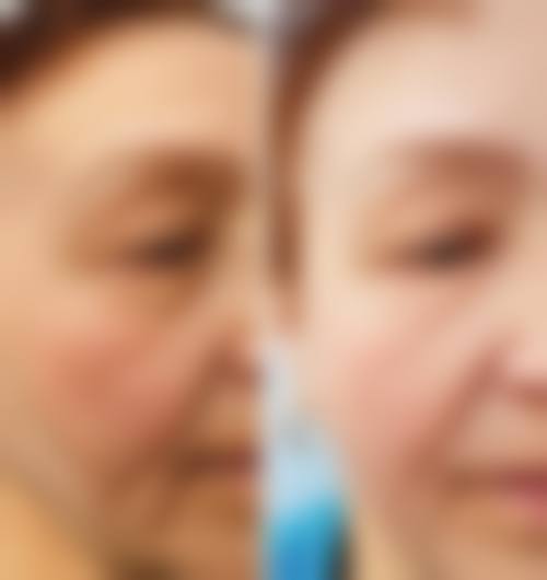 李艳艳医生实例