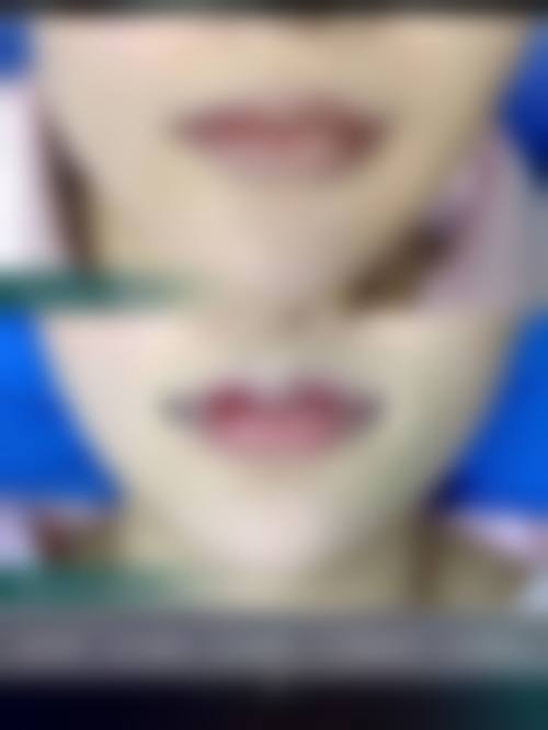 八、杭州赫瑞拉医疗美容门诊部真实的顾客评价如下: