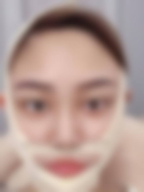 七、泉州斯美乐轮毂整形美容医院真实的顾客评价如下: