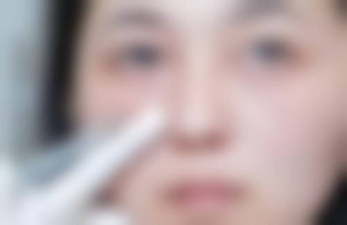 隆鼻假体对人体有害吗？揭秘常见风险及降低隆鼻假体危害的有效方法 