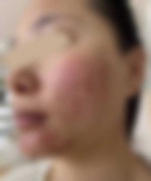 李易蔓医生口碑和评价