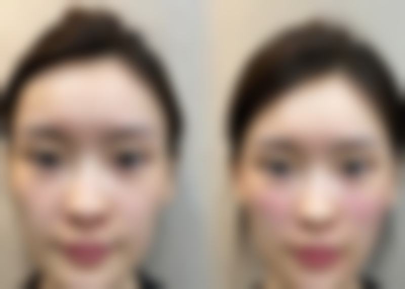 四、杭州悦色医疗美容诊所实例