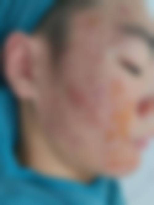 六、无锡中医医院整形美容科怎么预约: