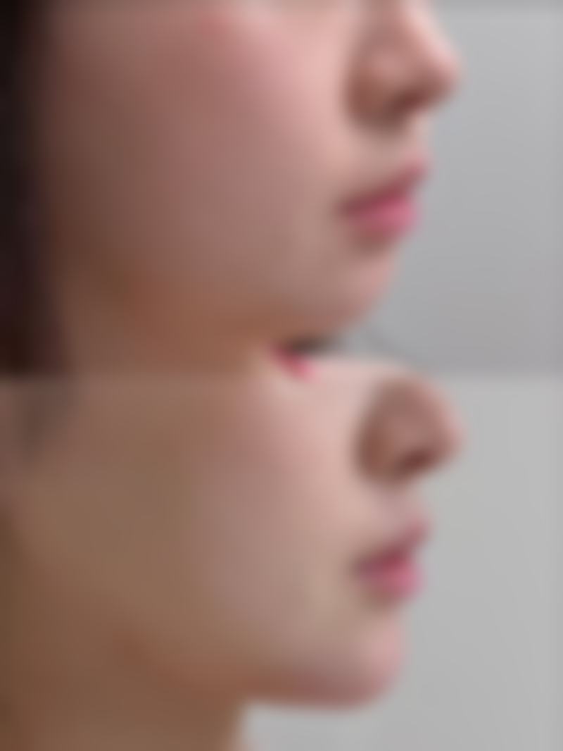 六、韩国Egline整形医院价格表:(仅供参考)