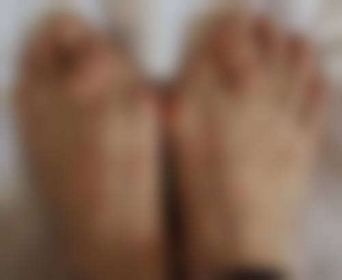 刚出生能割双眼皮吗?手术条件的重要性