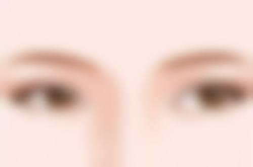 刚出生能割双眼皮吗?总结与建议