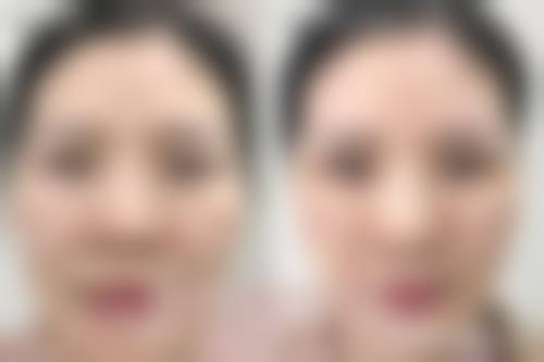 五、襄阳熙蒙医疗美容实例