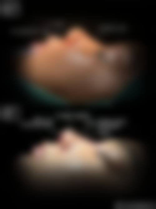 七、襄阳熙蒙医疗美容价格表:(仅供参考)