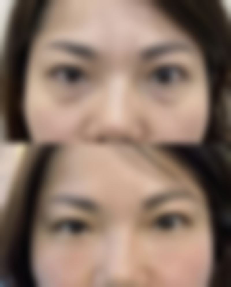 七、东莞天瑜整形医院真实的顾客评价如下: