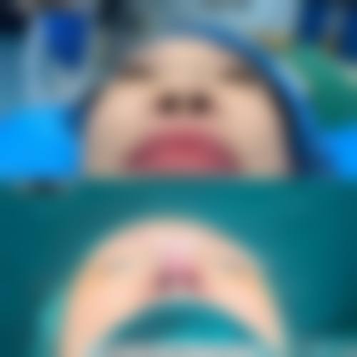 四、贵阳科珑小可整形医院实例