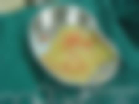 七、陕西省人民医院烧伤整形医学美容外科价格表:(仅供参考)
