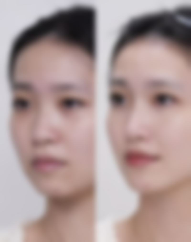 七、贵阳科珑小可整形医院真实的顾客评价如下:
