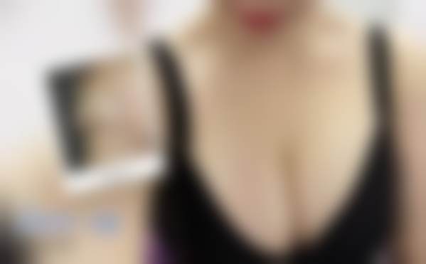 北京禾美嘉医疗美容门诊部任学会:极高的手术口碑