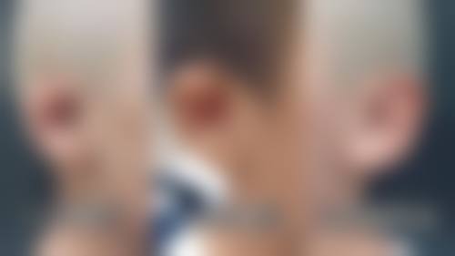 打完瘦脸针后开启美容之旅：优势尽显