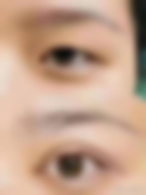 邹红医生实例