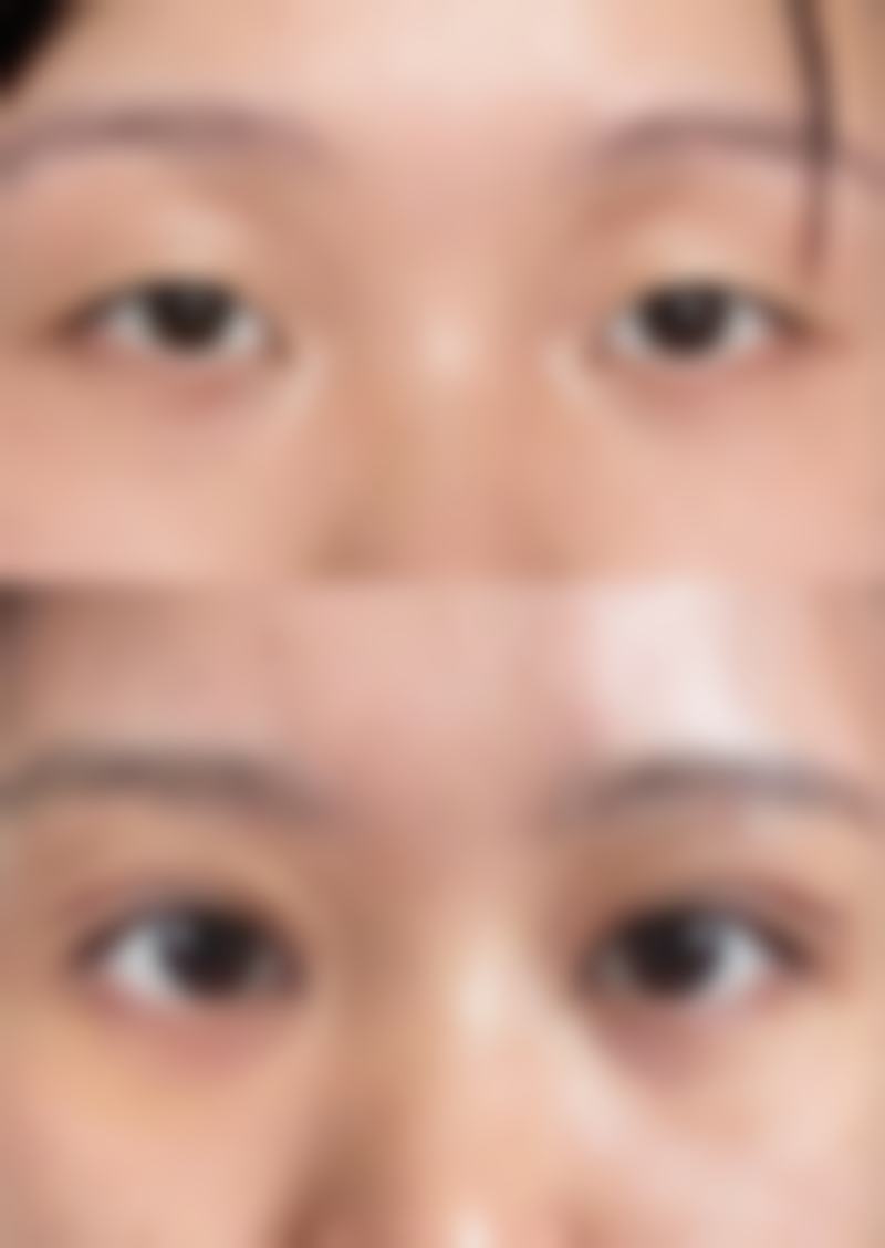 五、深圳谢琼西医皮肤科诊所实例：