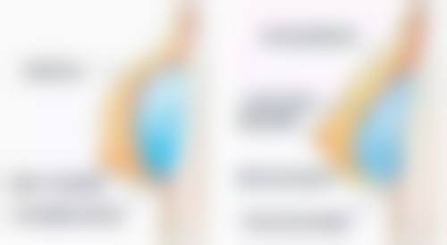 阴道紧缩术后：影响同房时间的因素有哪些