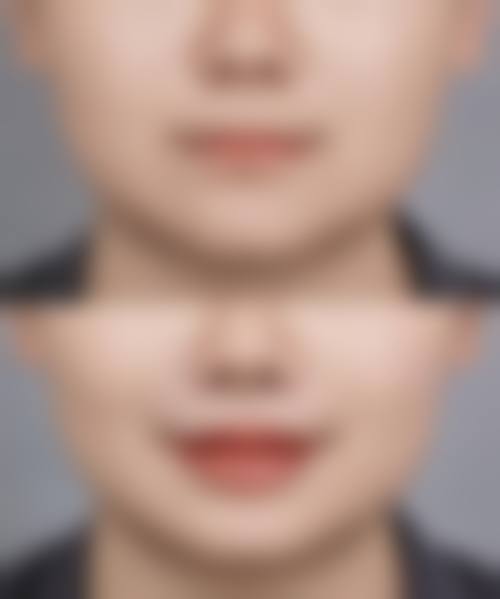 七、来客整形外科价格表：（仅供参考）