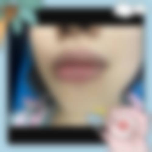 五、来客整形外科实例