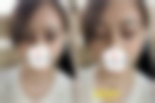 七、郑州聂丽丽医疗美容诊所真实的顾客评价如下：