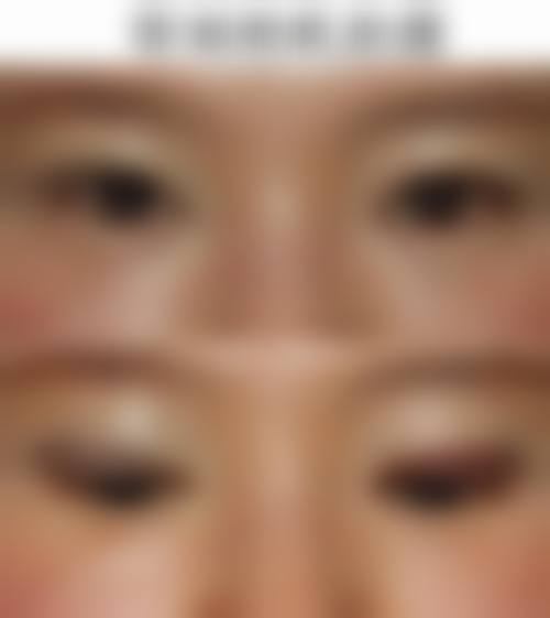 四、郑州聂丽丽医疗美容诊所实例