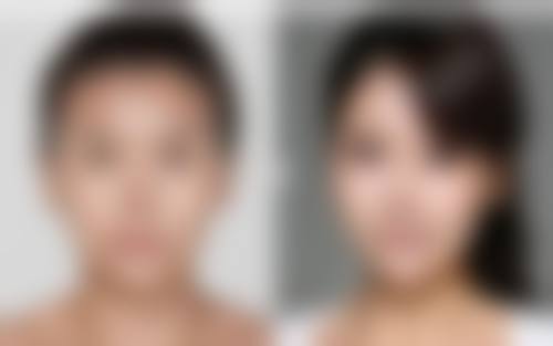 内双眼皮究竟是如何“炼成”的?其他补充成因探秘