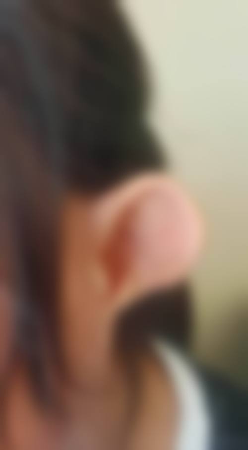 八、泉州儿童医院整形美容外科真实的顾客评价如下: