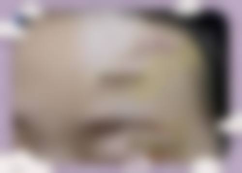 三、应城人民医院美容整形医生介绍: