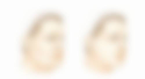 鼻综合隆鼻疼痛难忍？术中麻醉无痛感，术后短期可缓解且有多种止痛妙招 