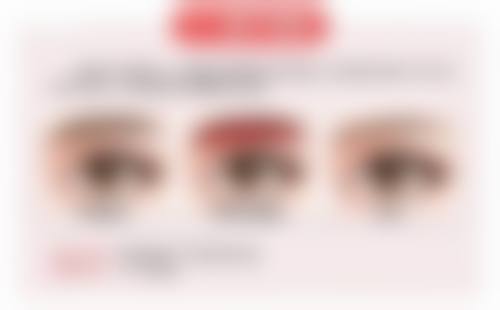 医生对鼻综合隆鼻疼痛怎么看?无需过度担忧