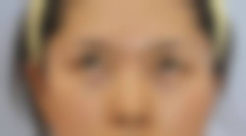 八、北京永林中医和西医结合医院美容整形科真实的顾客评价如下:
