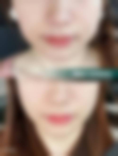 五、蚌埠立方医疗美容整形医院实例