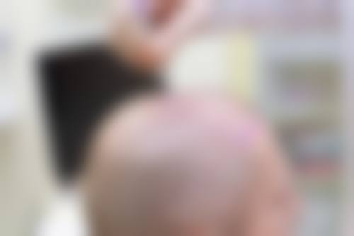 八、青岛大麦植发医院(原科发源)真实的顾客评价如下: