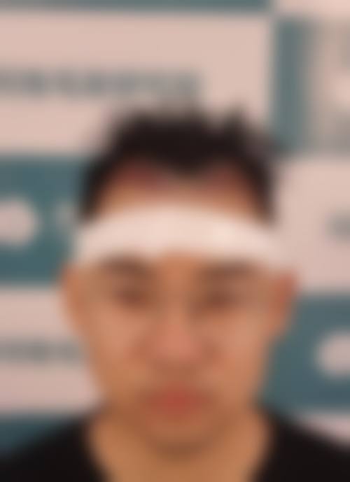 七、青岛大麦植发医院(原科发源)价格表:(仅供参考)